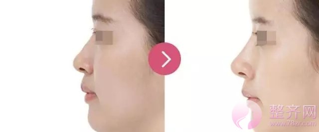 在这个看脸的时代,鼻子才是重要指标