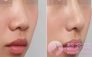 在这个看脸的时代,鼻子才是重要指标