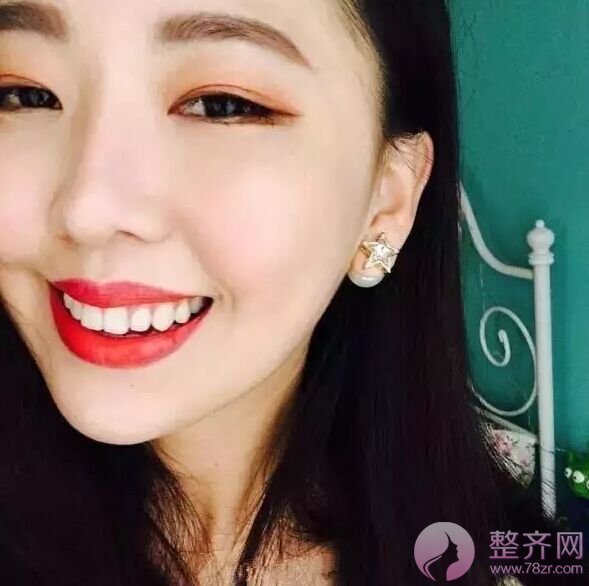 网红直播割双眼皮,美出一片天