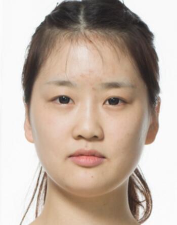 整形手术后,身边的人都来问我做了哪些变美的