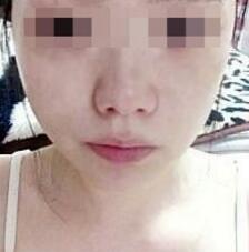 我的肉鼻子终于摆脱了,大家来看呀~