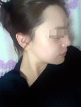 我的肉鼻子终于摆脱了,大家来看呀~