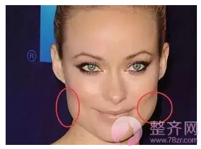 打完注射瘦脸没果?可能你犯了这些禁忌!