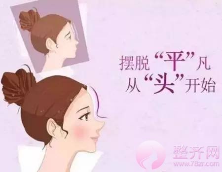 丰额头,助你丰出好运气