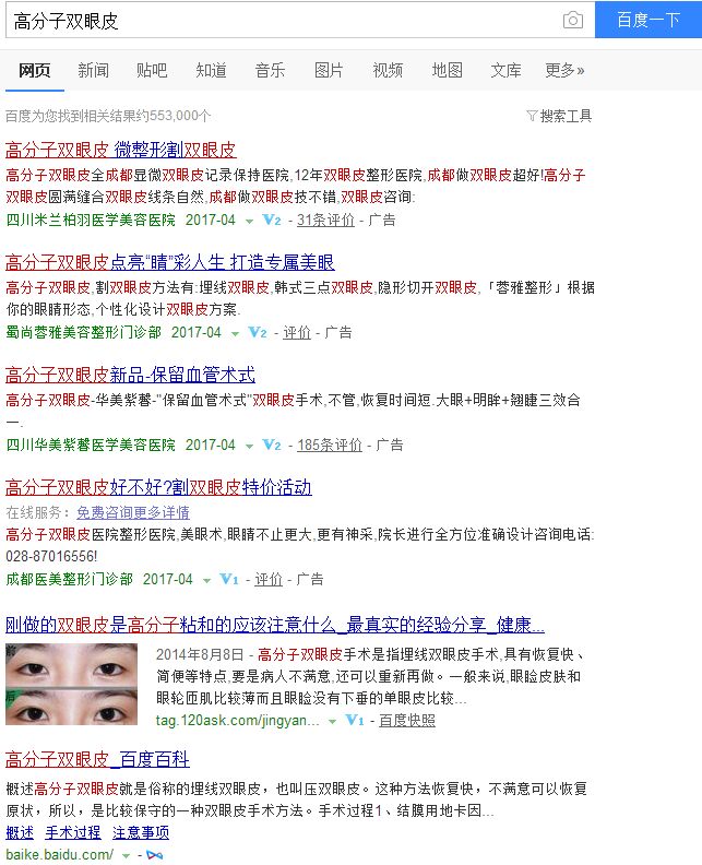 双眼皮整形手术的这20个知识点,你一定要知道
