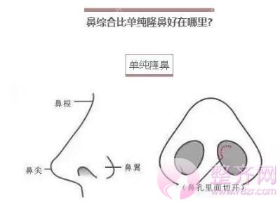 你是适合做隆鼻还是鼻部手术?
