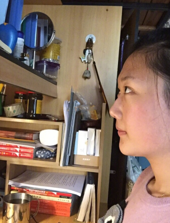 做额头究竟是假体还是自体脂肪呢?