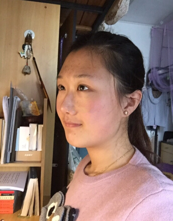 做额头究竟是假体还是自体脂肪呢?