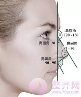 为什么做完鼻子还是不满意?