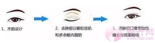 双眼皮到底有多重要?