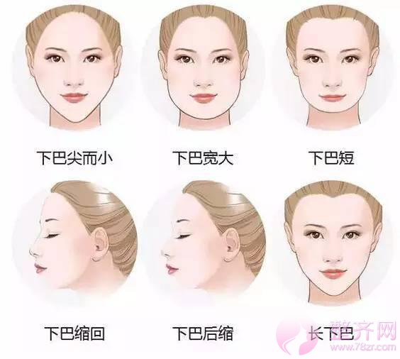 鼻梁挺,眼睛大,没有下巴全白搭!