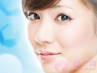 眼部、鼻部、隆胸、的切口都藏在哪里?