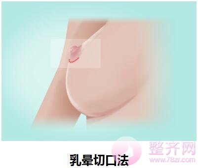 眼部、鼻部、隆胸、的切口都藏在哪里?
