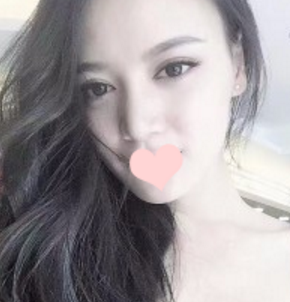 在南宁做的鼻部手术手术,果超喜欢~