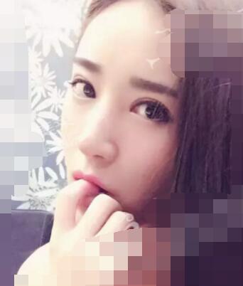 做了自体脂肪填充后,回到了我的少年时代,哈