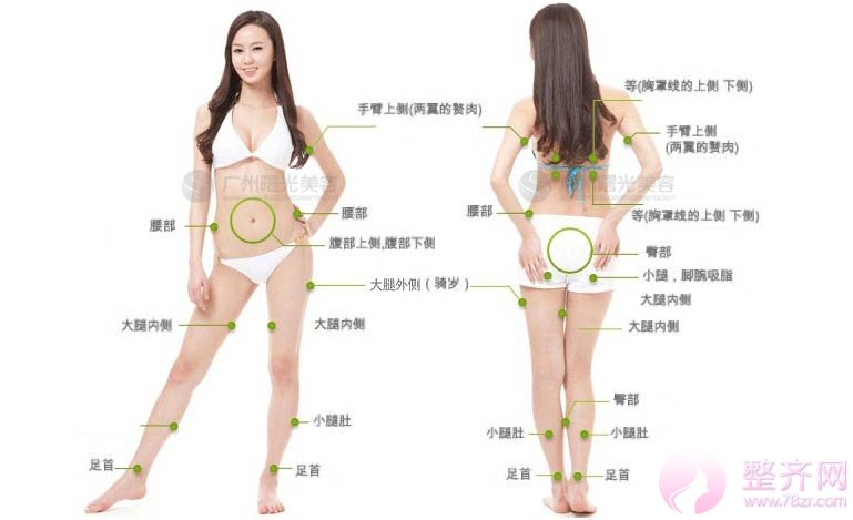 吸脂减肥多久恢复?