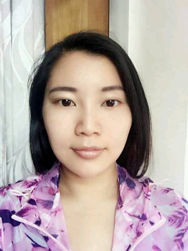 自体脂肪填充术后40天.。很真实的图片!欢迎对比,欢迎拍砖!