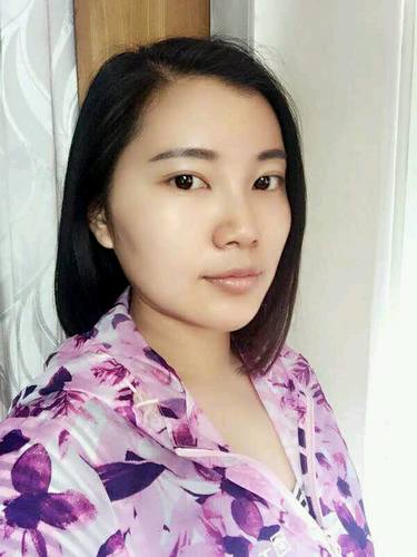 自体脂肪填充术后40天.。很真实的图片!欢迎对比,欢迎拍砖!