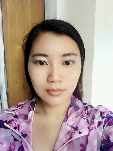 自体脂肪填充术后40天.。很真实的图片!欢迎对比,欢迎拍砖!