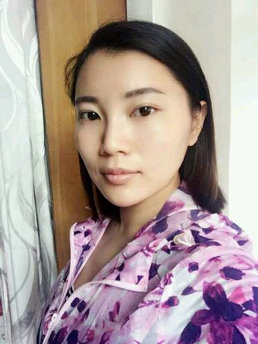 自体脂肪填充术后40天.。很真实的图片!欢迎对比,欢迎拍砖!