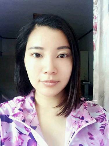 自体脂肪填充术后40天.。很真实的图片!欢迎对比,欢迎拍砖!
