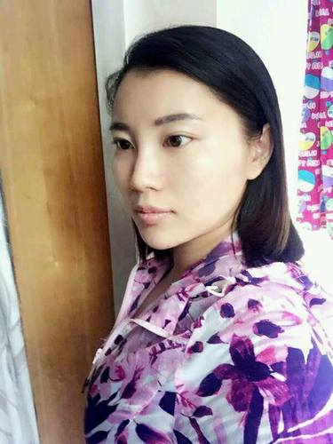 自体脂肪填充术后40天.。很真实的图片!欢迎对比,欢迎拍砖!