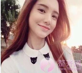 埋线提升为什么贵?