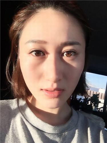 福利继续走起!更新一波福利~~~!全切双眼皮,各位MM们来看看你的双眼皮有木要他的做的自然呢?