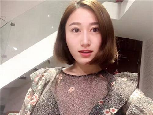 福利继续走起!更新一波福利~~~!全切双眼皮,各位MM们来看看你的双眼皮有木要他的做的自然呢?
