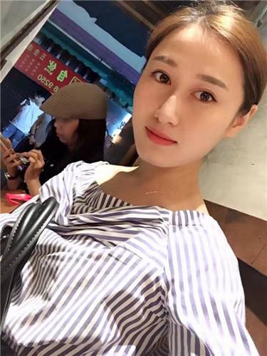 福利继续走起!更新一波福利~~~!全切双眼皮,各位MM们来看看你的双眼皮有木要他的做的自然呢?