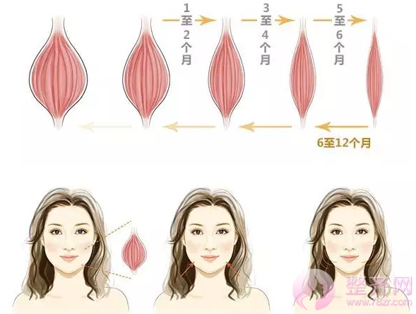 如何拥有精致小V脸?