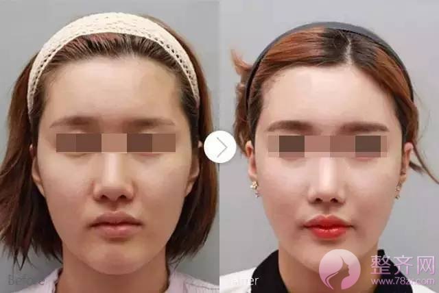 为什么自己做的鼻子感觉往往没别人的好看?