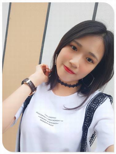 自体脂肪填充全脸案例走起!今天为大家分享的是自体脂肪!有妹子要求多上传点面部填充的案例!小主就上传了,你看我对你们多好,你想要的,你想了解的案例,我都给你!么么哒!