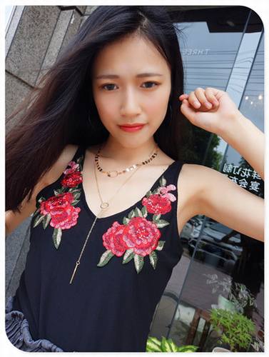 自体脂肪填充全脸案例走起!今天为大家分享的是自体脂肪!有妹子要求多上传点面部填充的案例!小主就上传了,你看我对你们多好,你想要的,你想了解的案例,我都给你!么么哒!
