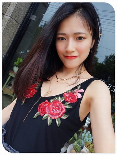 自体脂肪填充全脸案例走起!今天为大家分享的是自体脂肪!有妹子要求多上传点面部填充的案例!小主就上传了,你看我对你们多好,你想要的,你想了解的案例,我都给你!么么哒!