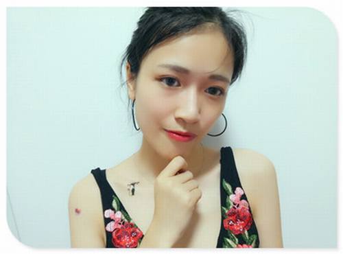 自体脂肪填充全脸案例走起!今天为大家分享的是自体脂肪!有妹子要求多上传点面部填充的案例!小主就上传了,你看我对你们多好,你想要的,你想了解的案例,我都给你!么么哒!