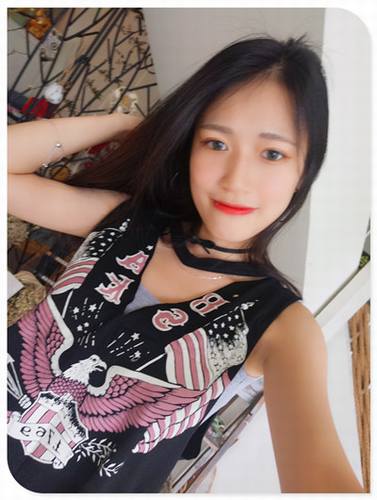 自体脂肪填充全脸案例走起!今天为大家分享的是自体脂肪!有妹子要求多上传点面部填充的案例!小主就上传了,你看我对你们多好,你想要的,你想了解的案例,我都给你!么么哒!