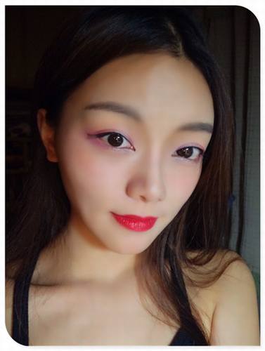 哎呀!有妹子主动反馈做鼻部手术的案例!小主十分高兴!这不,马上发来给大家瞧瞧!这还是自体软骨隆鼻哦!个人觉得这鼻子真心好看!完美!perfect!手动比心!比心!