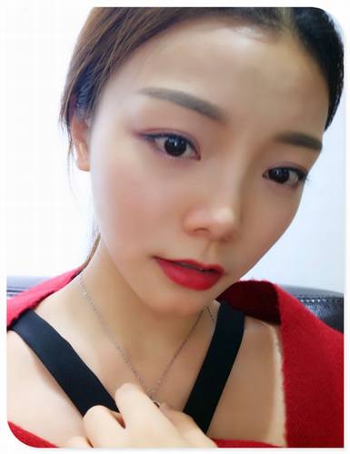 哎呀!有妹子主动反馈做鼻部手术的案例!小主十分高兴!这不,马上发来给大家瞧瞧!这还是自体软骨隆鼻哦!个人觉得这鼻子真心好看!完美!perfect!手动比心!比心!