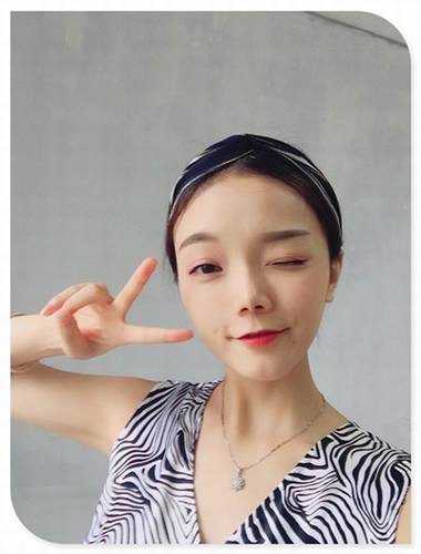 哎呀!有妹子主动反馈做鼻部手术的案例!小主十分高兴!这不,马上发来给大家瞧瞧!这还是自体软骨隆鼻哦!个人觉得这鼻子真心好看!完美!perfect!手动比心!比心!