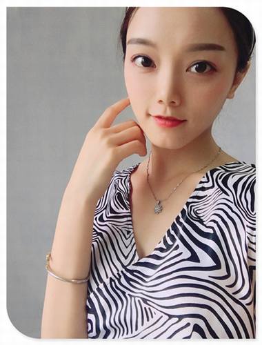 哎呀!有妹子主动反馈做鼻部手术的案例!小主十分高兴!这不,马上发来给大家瞧瞧!这还是自体软骨隆鼻哦!个人觉得这鼻子真心好看!完美!perfect!手动比心!比心!