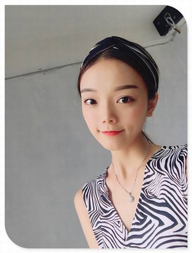 哎呀!有妹子主动反馈做鼻部手术的案例!小主十分高兴!这不,马上发来给大家瞧瞧!这还是自体软骨隆鼻哦!个人觉得这鼻子真心好看!完美!perfect!手动比心!比心!