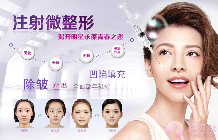 微整形时代来临,爱动刀子不如爱打针!