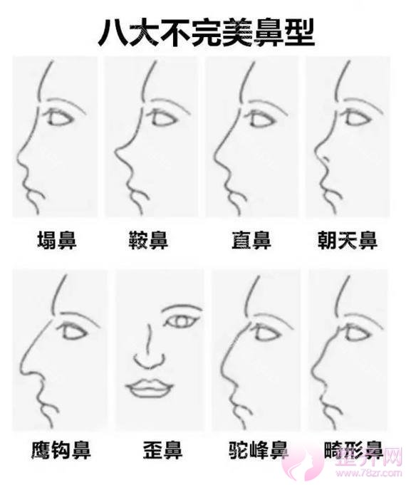 隆鼻和鼻部手术差别在哪?哪种更自然?