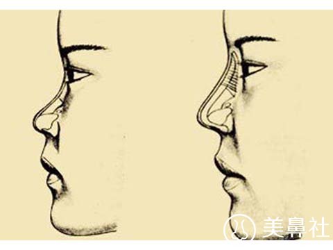北京八大处刘暾介绍