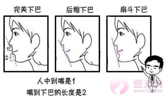 脸型太短怎么办?假体隆下巴没问题吗?