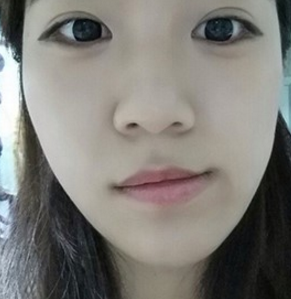 脸型不对称怎么办?看看我的日记分享啦!