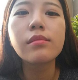 脸型不对称怎么办?看看我的日记分享啦!