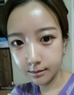 脸型不对称怎么办?看看我的日记分享啦!