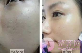 【水光补水真的那么神奇?什么皮肤都能救?】